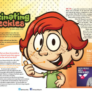 FASCINATING FRECKLES ARTICLE